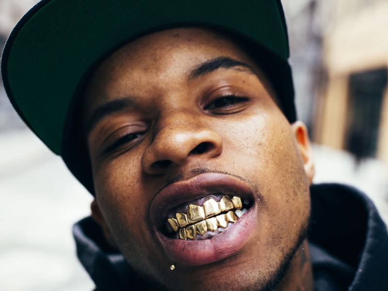 Tory Lanez with gold teeth grills © Daily Chiefers