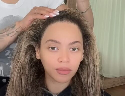 Beyoncé Speaks Publicly About Her Lifelong Struggle With Scalp Psoriasis